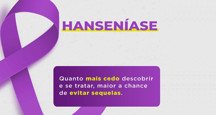 Notícia - Ações do Janeiro Roxo conscientizam sobre a hanseníase